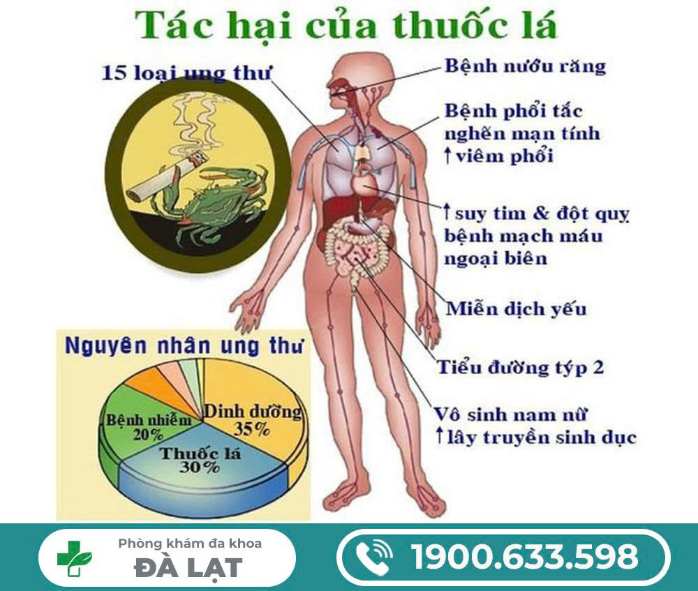 Hình ảnh minh họa